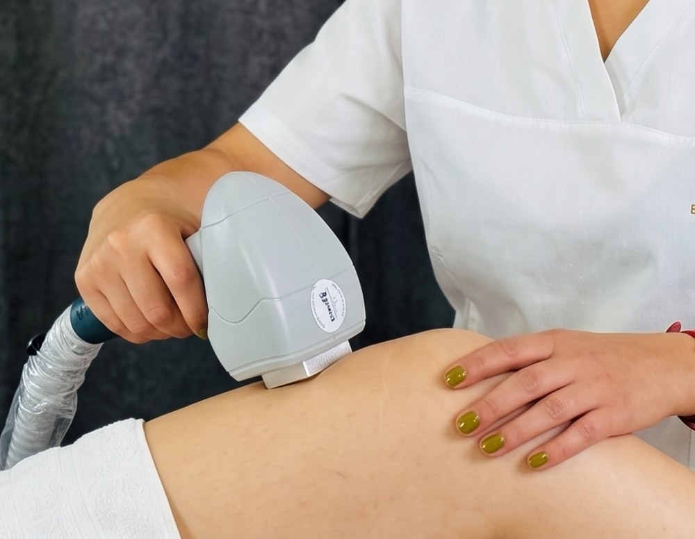 3W Ice Laser Handstück bei der Laser-Haarentfernung im Studio Bites of Beauty