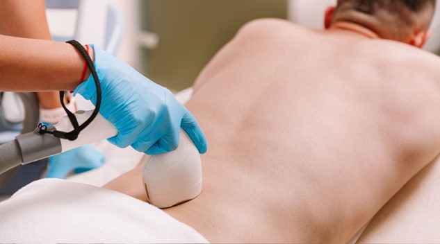 Preis der Laser-Haarentfernung in Düsseldorf: Qualität und Wettbewerbsfähigkeit bei Bites of Beauty | bitesofbeauty.de