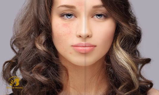 Einführung in Gesichtsbehandlungen und Entdeckung der Dienstleistungen bei Bites of Beauty