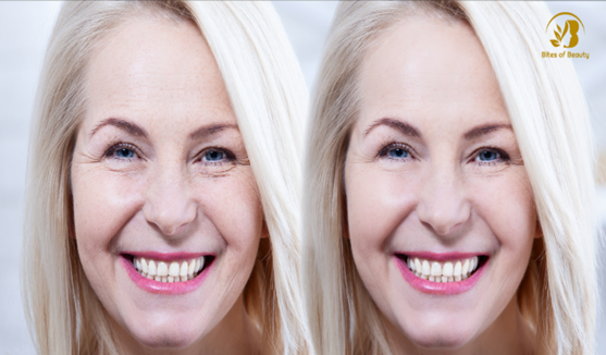 Einführung in Gesichtsbehandlungen und Entdeckung der Dienstleistungen bei Bites of Beauty
